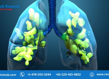 Acute Respiratory Distress Syndrome Market, Global Forecast Report 2023-2028