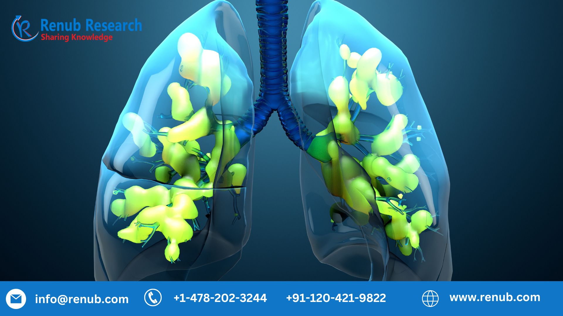 Acute Respiratory Distress Syndrome Market, Global Forecast Report 2023-2028
