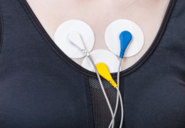 Cardiac Holter Monitor Market, Size, Global Forecast 2023-2030, Industry Trends, Share, Growth