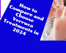 How to Compare and Choose Verruca Treatments in 2024