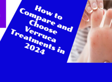 How to Compare and Choose Verruca Treatments in 2024