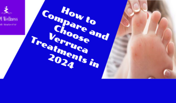 How to Compare and Choose Verruca Treatments in 2024